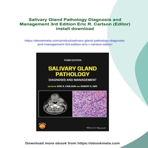 Salivary Gland Pathology Diagnosis and Management 3rd Edition Eric R ...