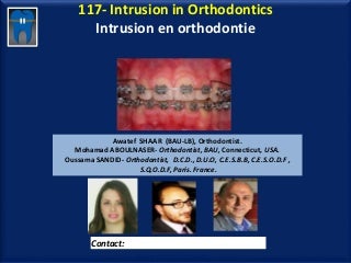117 intrusion in orthodontics-oussama sandid-mohamad aboualnaser-mohamad aboualnaser-awatef shaar-oussama sandid-orthodontist-orthodontist