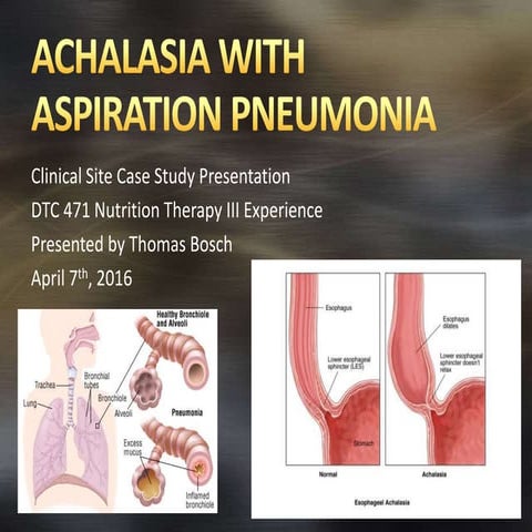 Achalasia with Aspiration Pneumonia