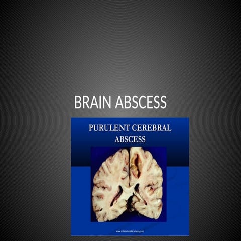 BRAIN ABSCESS,ITS CAUSES AND PHYSIOTHERAPY MANAGMENT | PPTX