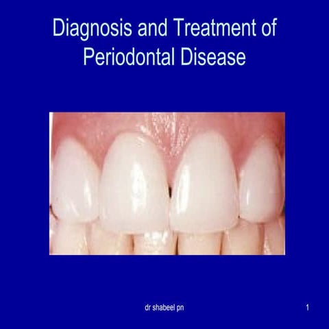 11diagnosis and treatment_of_periodontal_disease dissan
