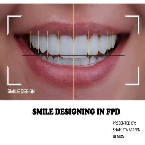 SMILE DESIGNING IN FPD Digital smile designing.pptx