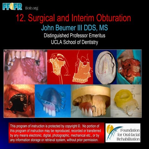 Surgical and Interim Obturation