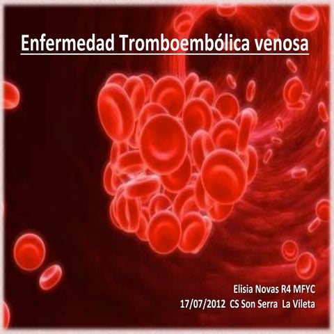 120717 enfermedad tromboembólica venosa pdf