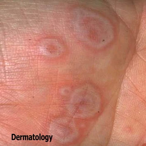 12 Dermatology2008 | PPT