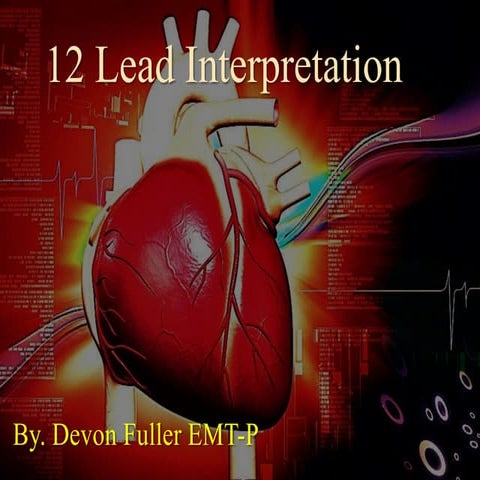 12 lead interpretation