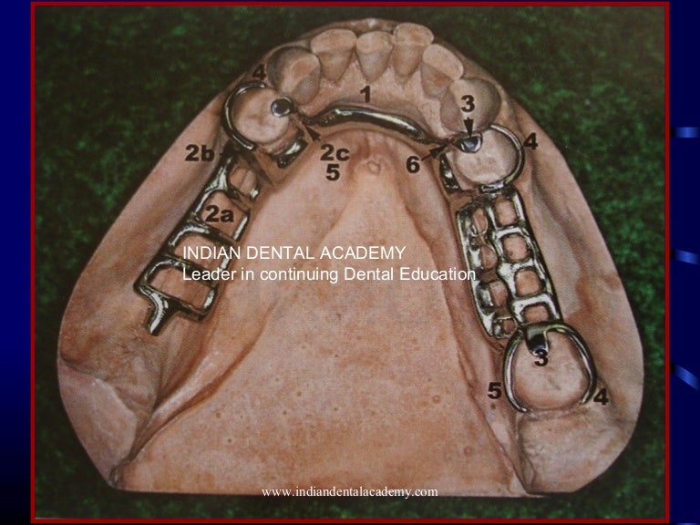 13.major connectors/ dental implant courses