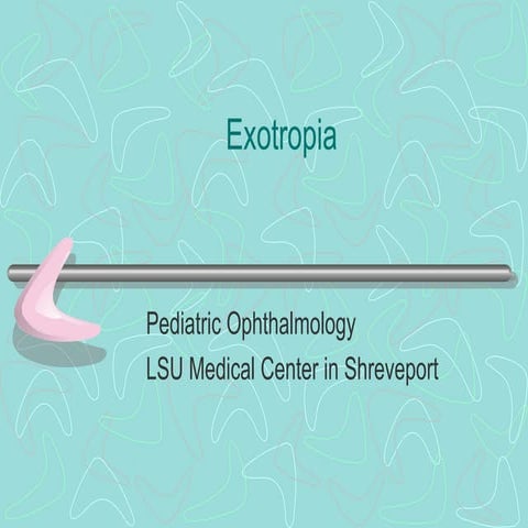 13 exotropia