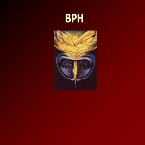 Benign Prostate Hipertrophy (BPH)   .ppt