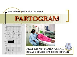 13 partogram