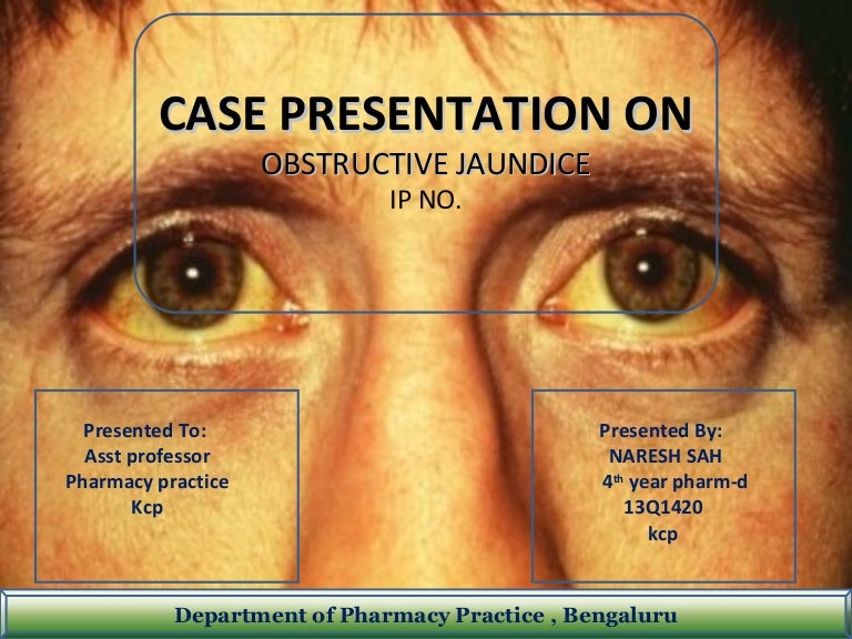 CASE PRESENTATION ON obstructive jaundice