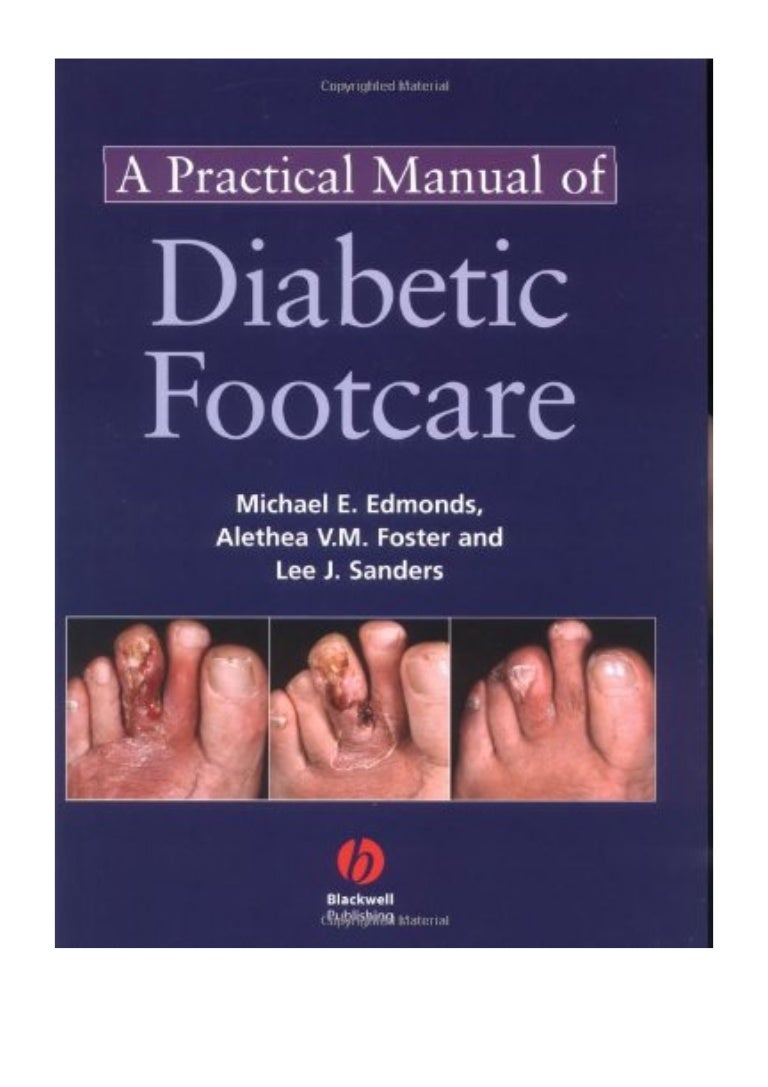(2004) A Practical Manual of Diabetic Foot Care (PDF) by Michael E.
