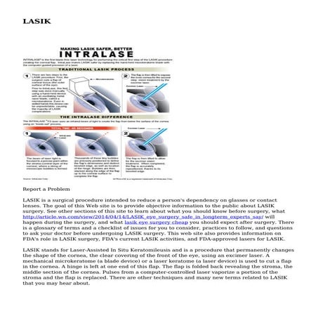 LASIK | PDF