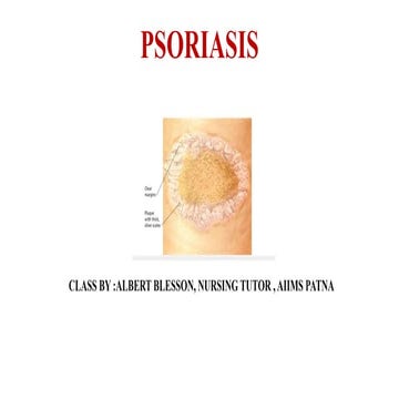  psoriasis