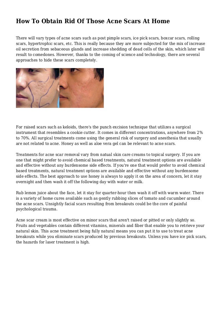 boxcar scars cream