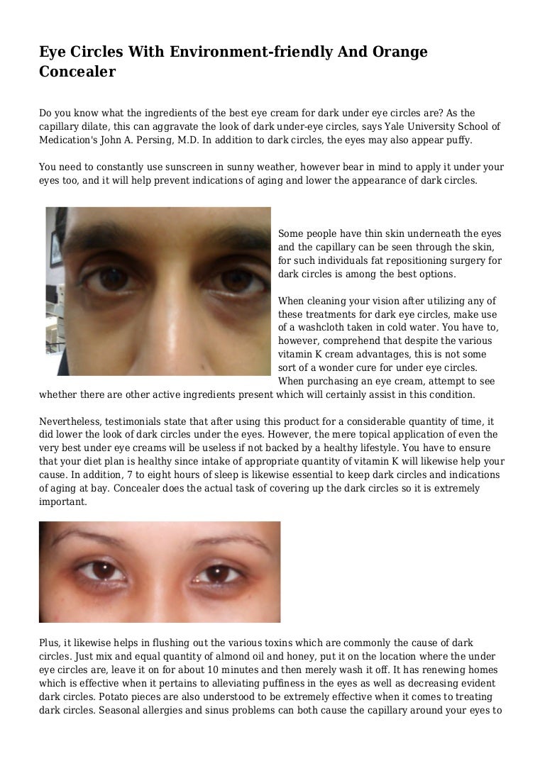 best ingredients for under eye circles