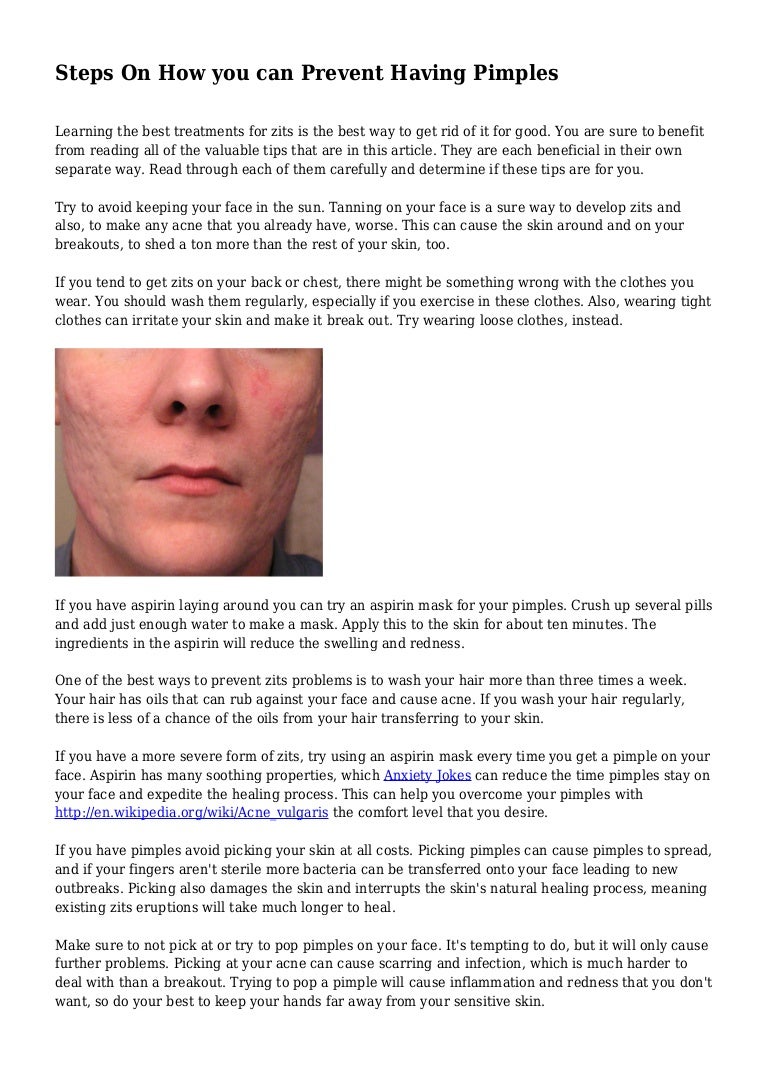Steps On How you can Prevent Having Pimples