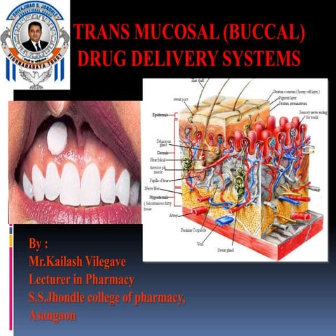 Transmucosal drug delivery by Kailash Vilegave