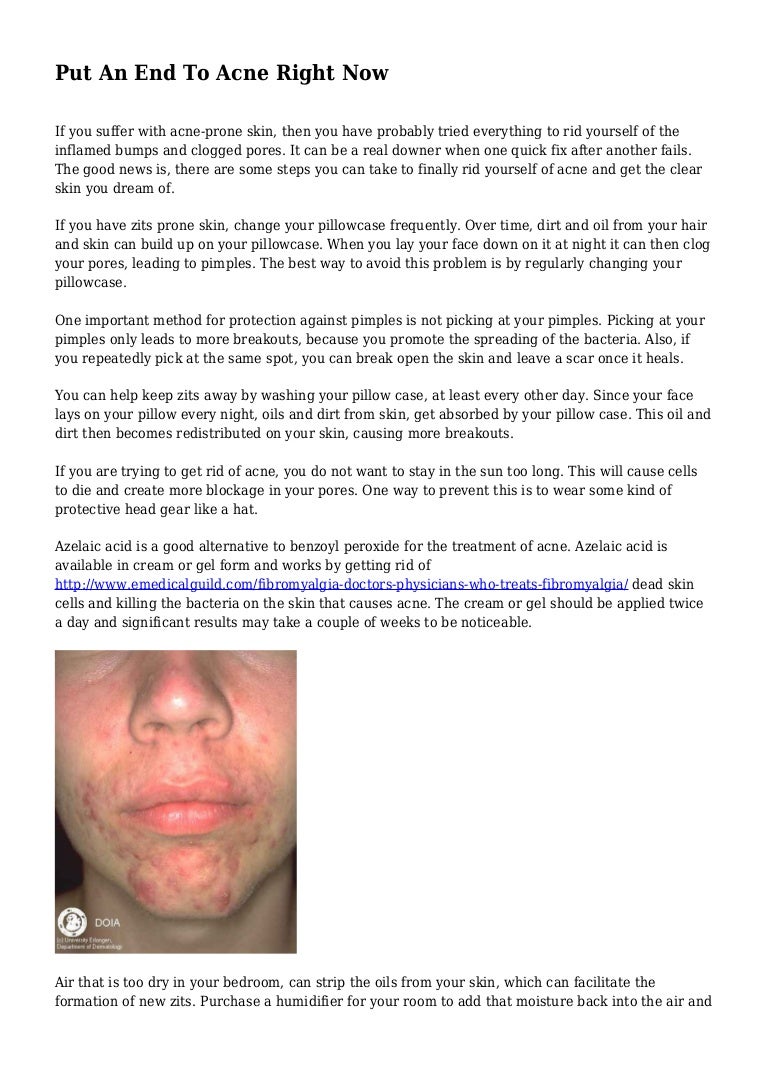 pillow cases causing acne