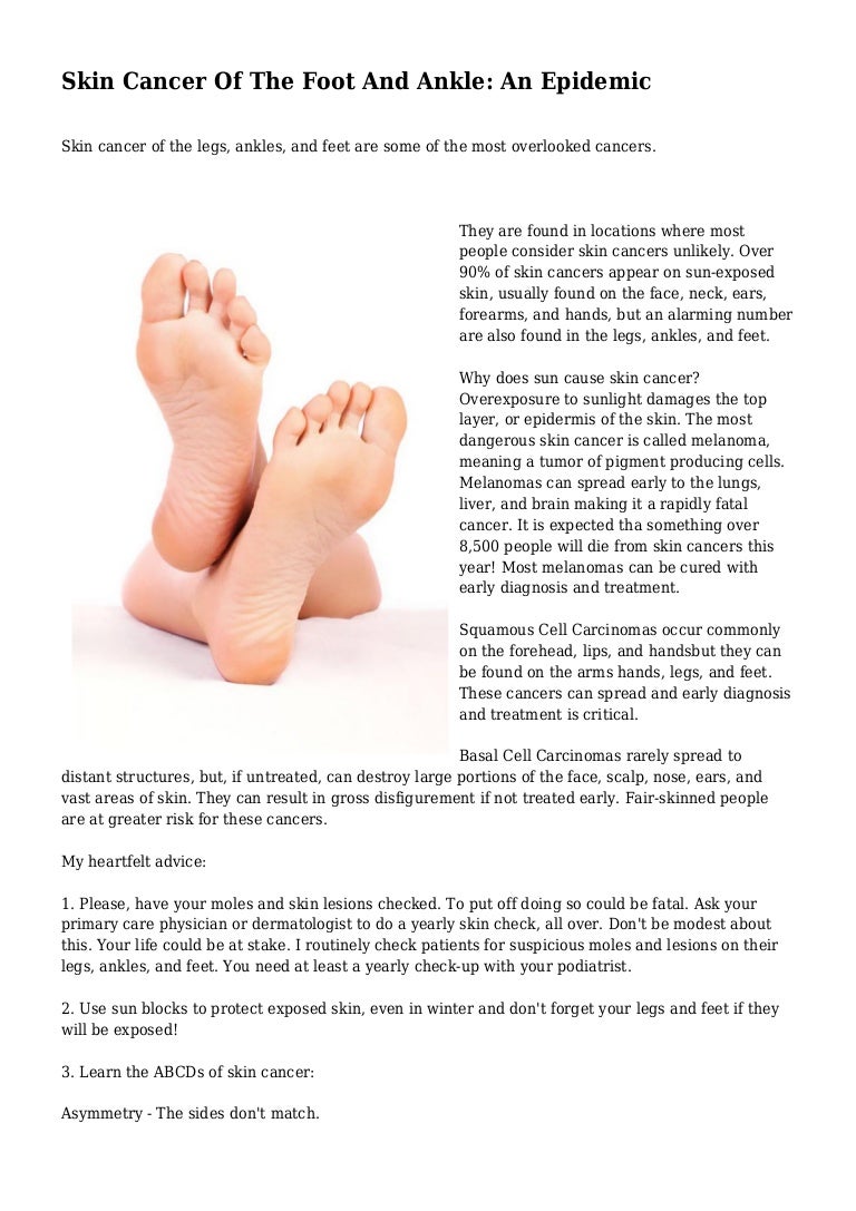 photo Skin Cancer On Foot skin cancer of the foot and ankle an