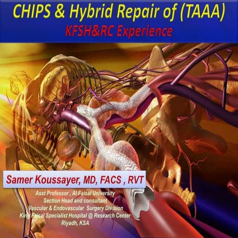 tevar-evar-ppt-by-dr-amrit-kumar-ctvs-pptx