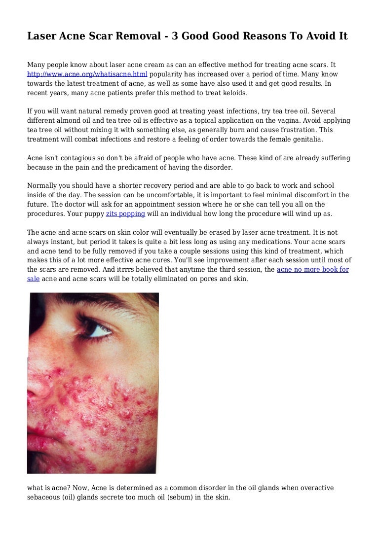 good scar treatment
