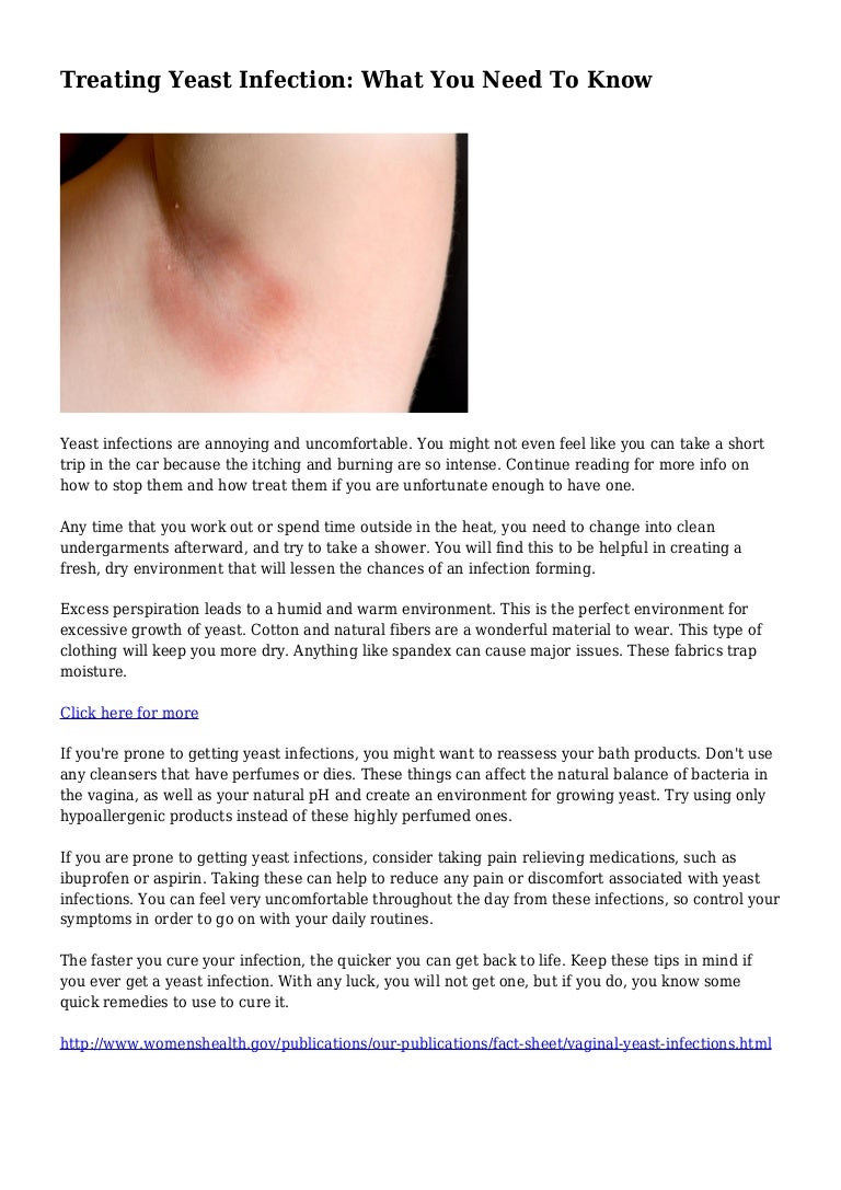 Treating Yeast Infection What You Need To Know