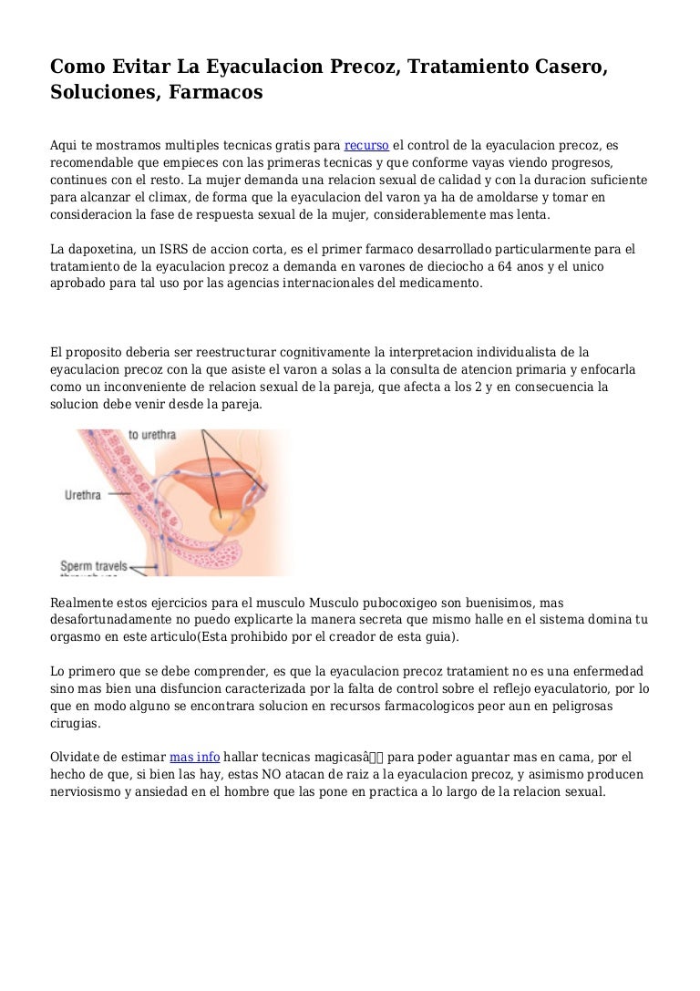 Como Evitar La Eyaculacion Precoz Tratamiento Casero Soluciones Fa