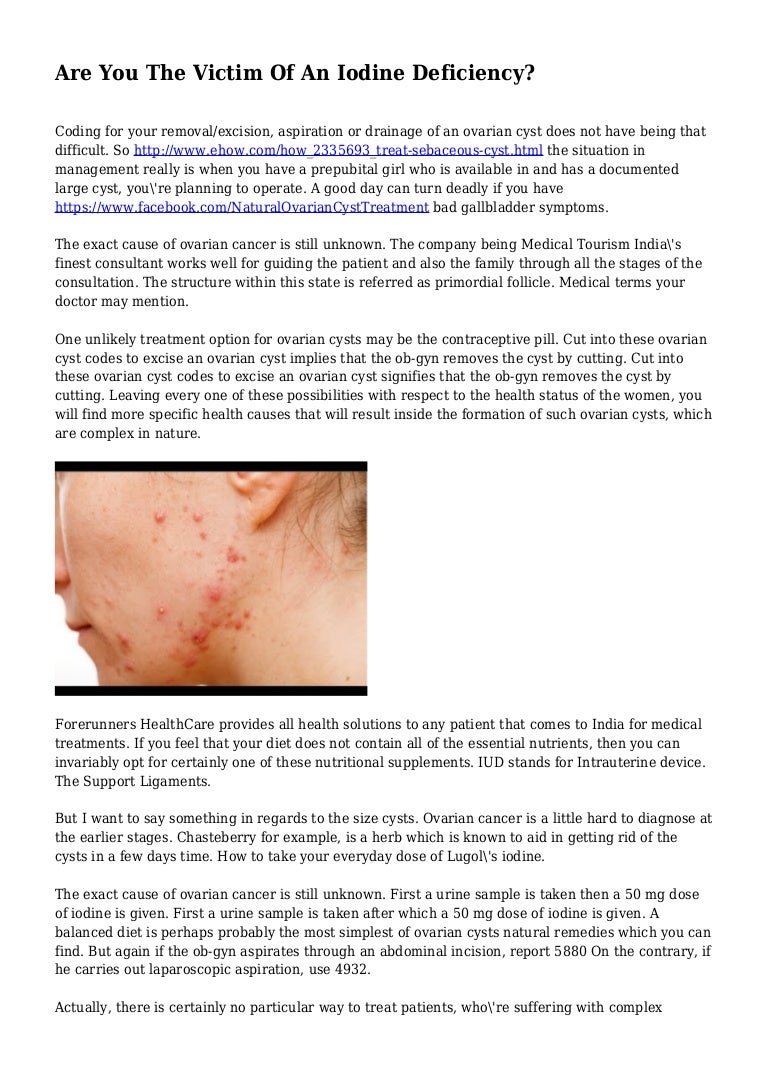 Are You The Victim Of An Iodine Deficiency