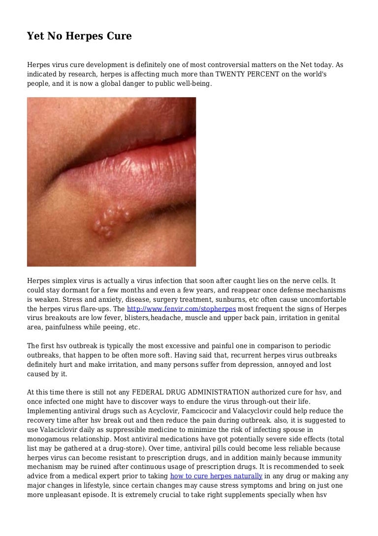 Yet No Herpes Cure