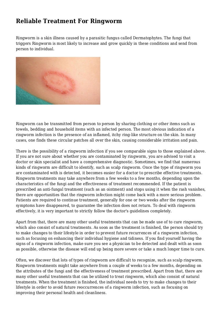 Reliable Treatment For Ringworm