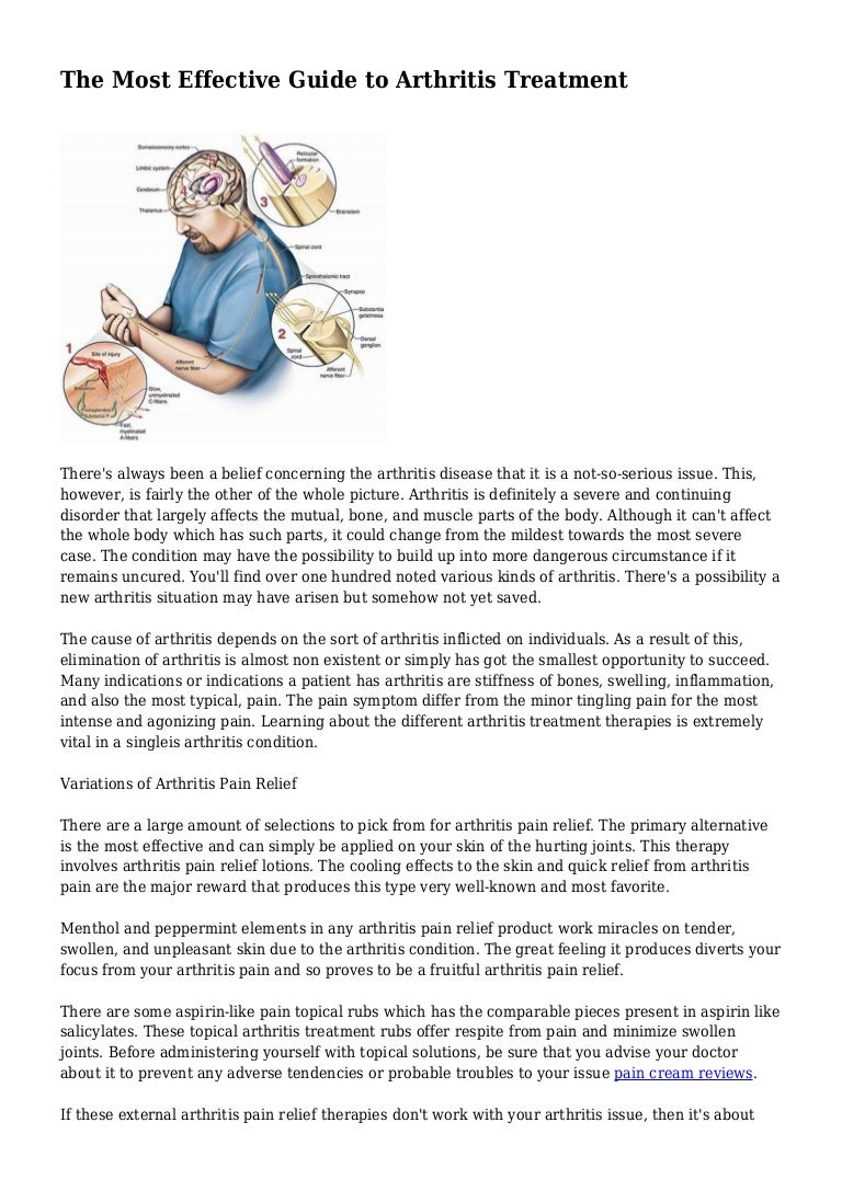 The Most Effective Guide to Arthritis Treatment