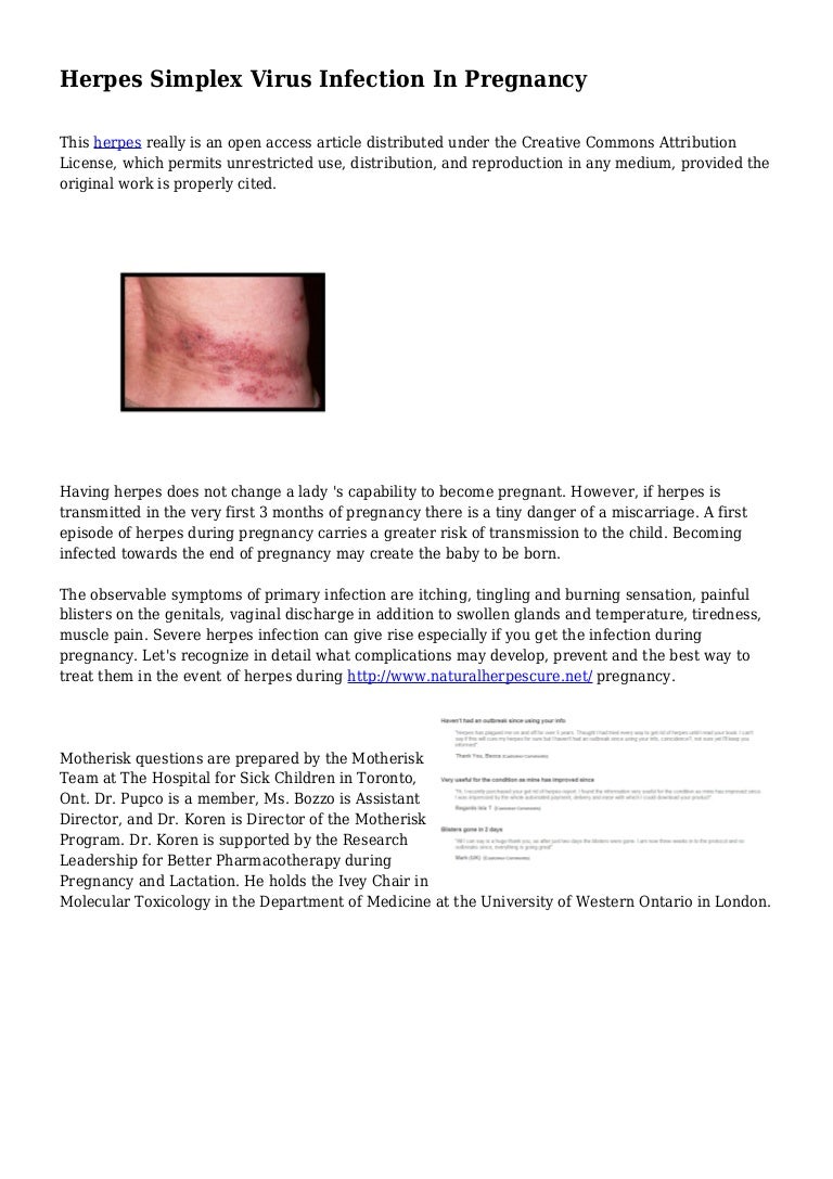 Herpes Simplex Virus Infection In Pregnancy