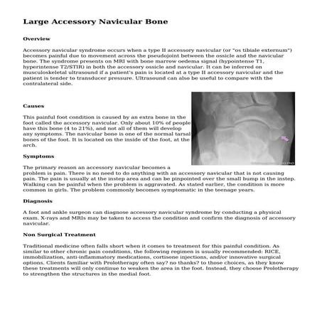 Accessory Navicular Bone.pptx
