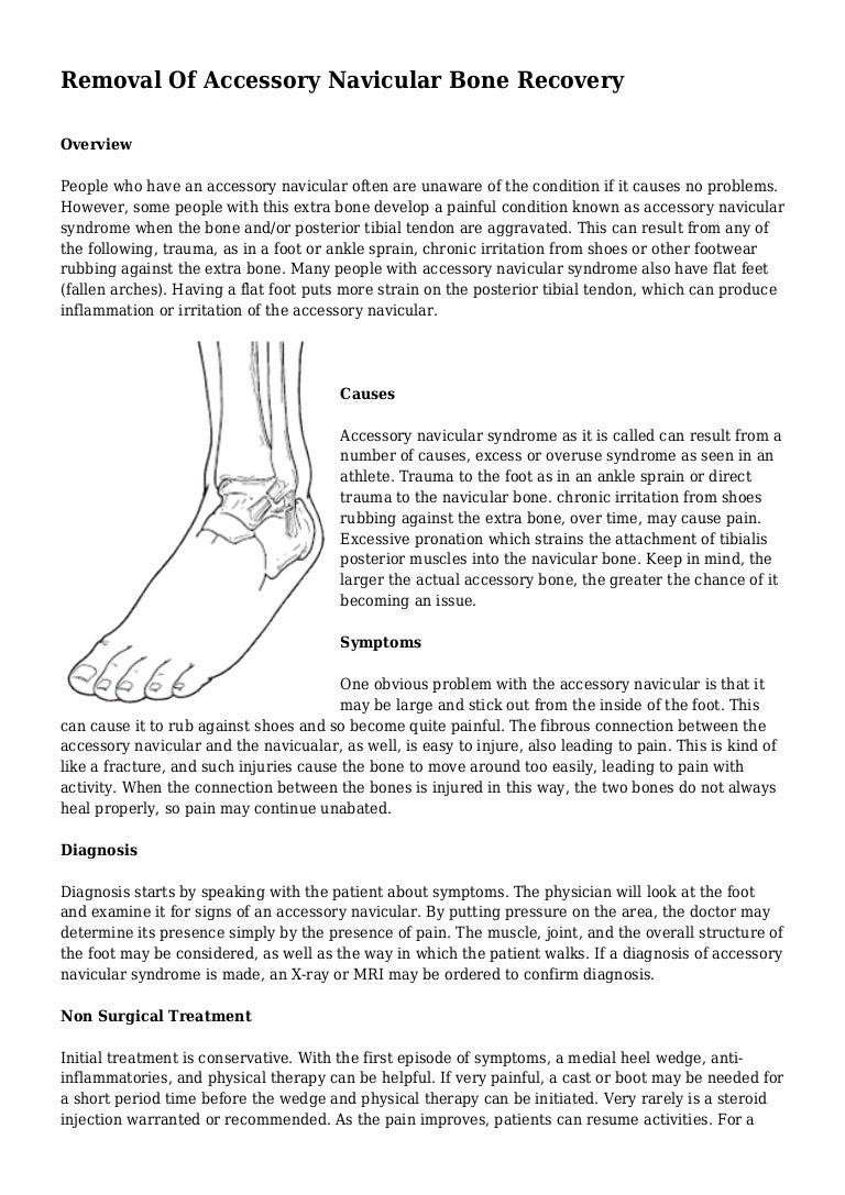Removal Of Accessory Navicular Bone Recovery