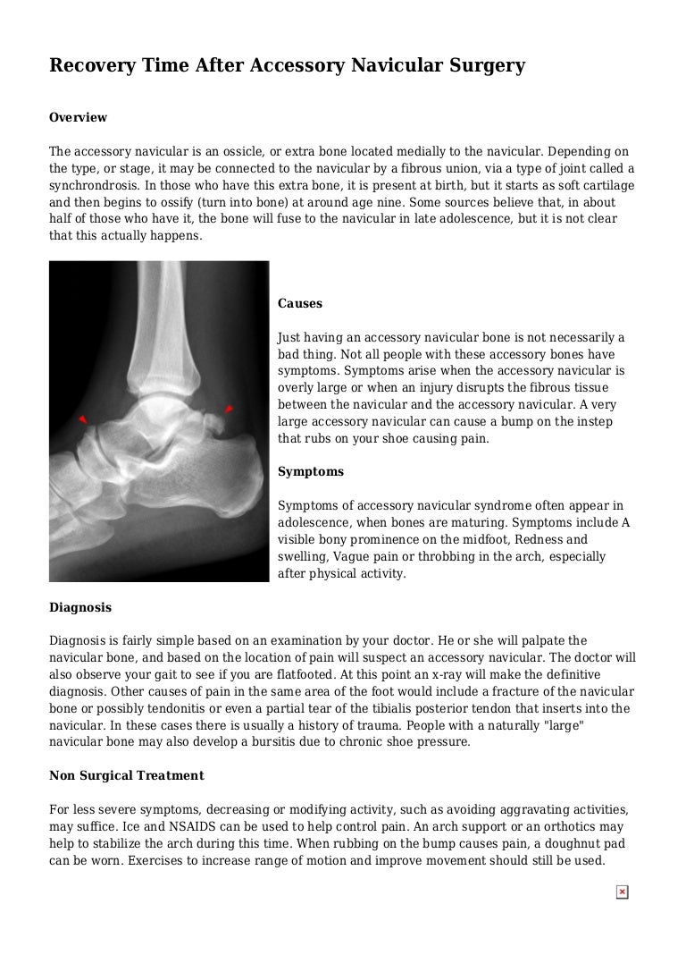 pseudartroza tratamentului periajului navicular