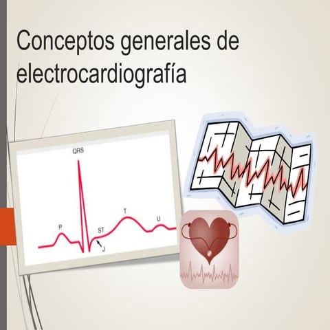 14 electrocardiograma ekg
