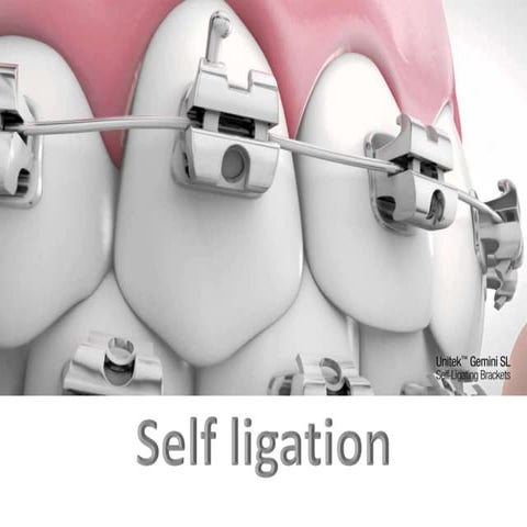 self ligation