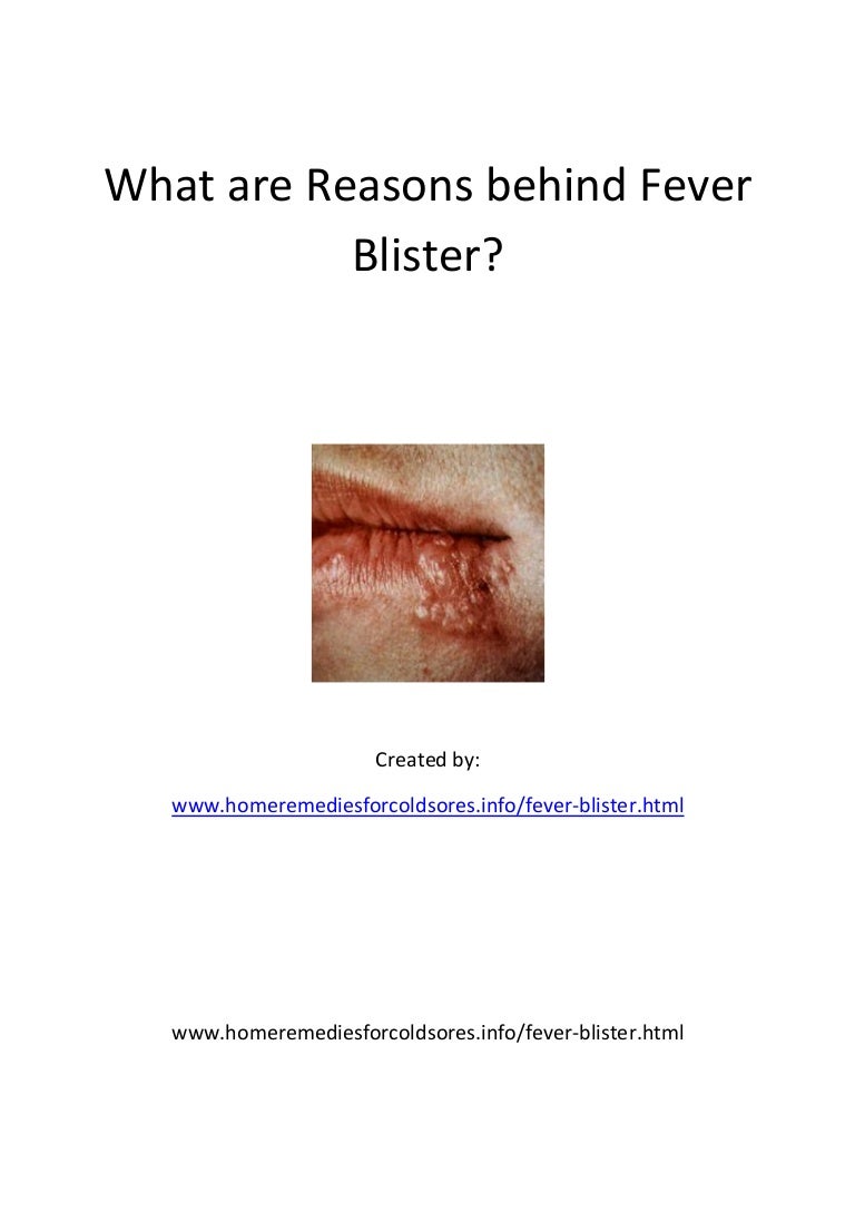 14 what are reasons behind fever blister
