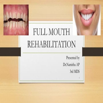 Full mouth rehabilitation FINAL PRESENTATION