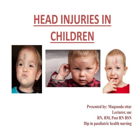 15.8  HEAD INJURY IN CHILD.pptx
