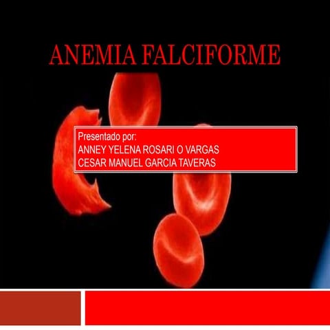 anemia falciforme