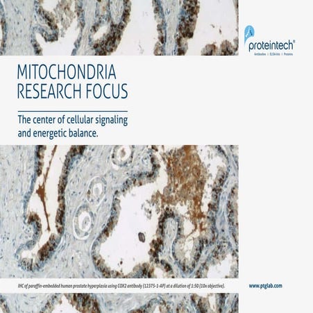 Mitochondria Research Focus