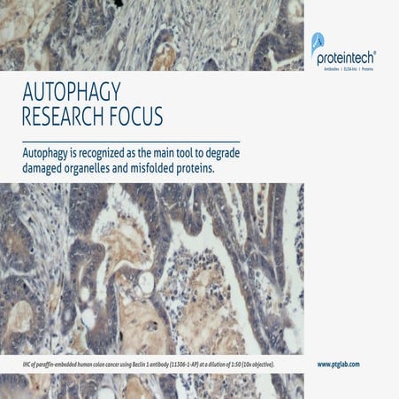 Autophagy Research Focus by Proteintech