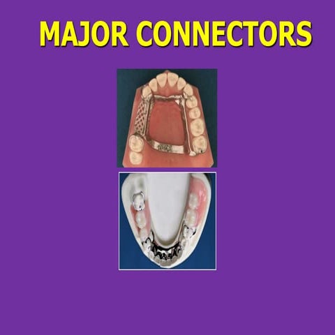 Components of RPD and Major connectors_Dr Shuchi Jain.pptx