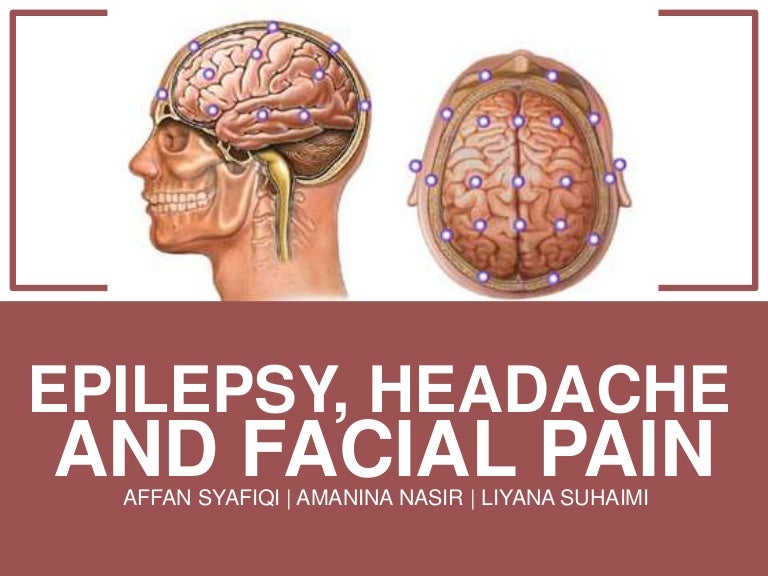 Epilepsy, headache and facial pain