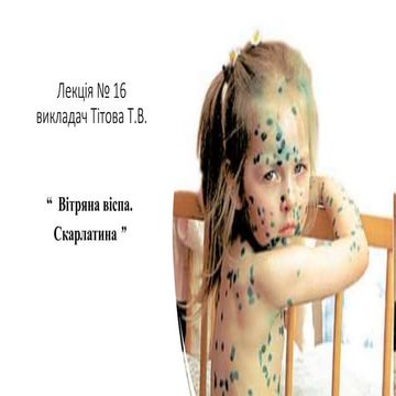 Лекція  Вітряна віспа Скарлатина .pptx