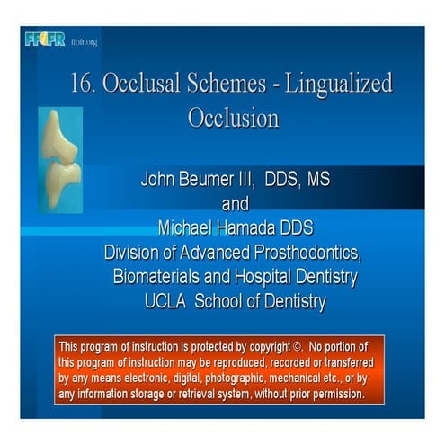 16.occlusal schemes   lingualized occlusion
