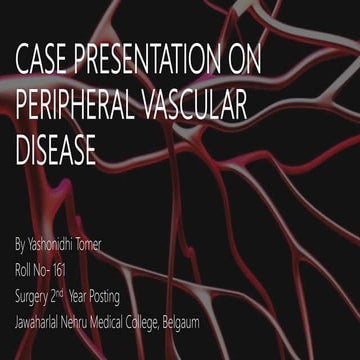 Peripheral Vascular Disease Case Presentation | PPTX
