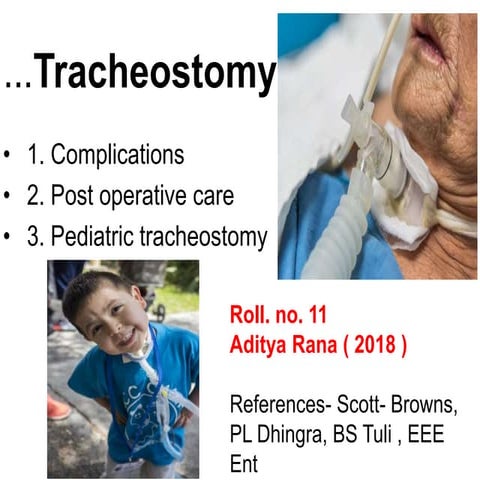 Tracheostomy complications pediatric by Aditya Rana mbbs 